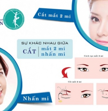 SỰ KHÁC NHAU GIỮA CẮT MẮT HAI MÍ VÀ NHẤN MÍ