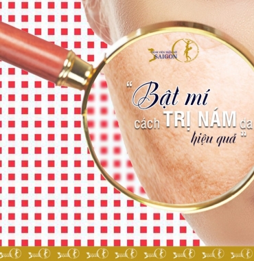 BẬT MÍ CÁCH TRỊ NÁM DA HIỆU QUẢ