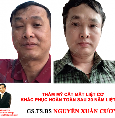Thẩm mỹ viện chuyên điều trị thẩm mỹ cơ mặt bị liệt mức độ nặng