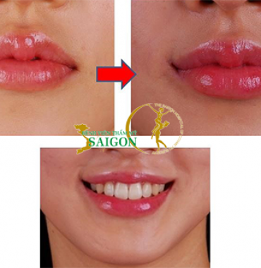 TẠO NÉT ĐẸP HIỆN ĐẠI CHO GƯƠNG MẶT