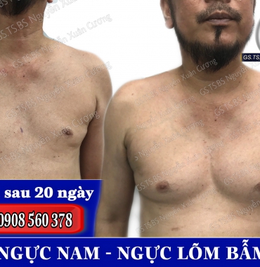Thẩm mỹ nâng ngực nam đẹp an toàn bác sĩ đầu ngành thực hiện